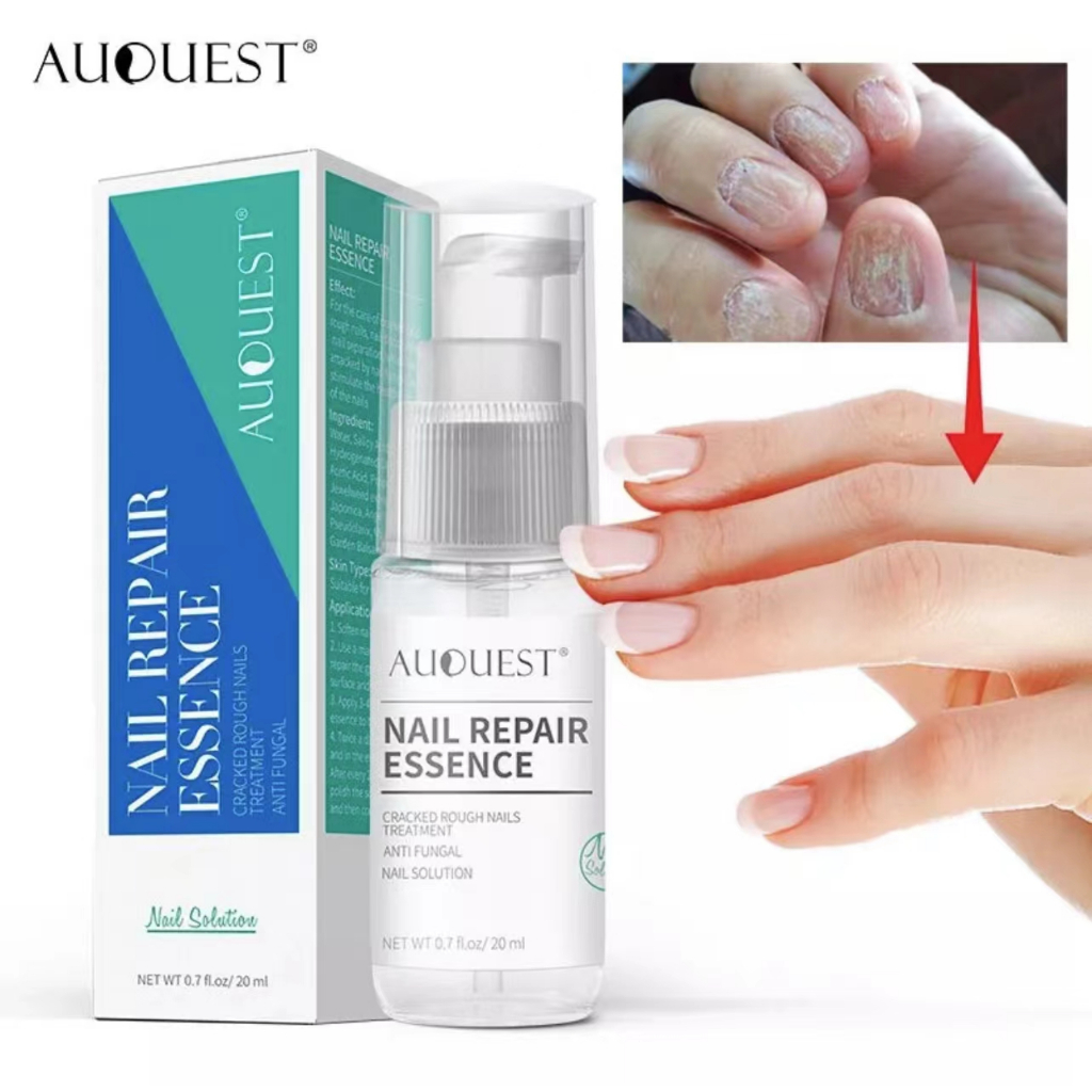 b2sperl4rk***AuQuest เซรั่มทาเล็บ น้ำมันทาเล็บ เซรั่มทาเล็บเสีย ออยทาเล็บ เล็บเท้า เชื้อราเล็บมือ 20ml