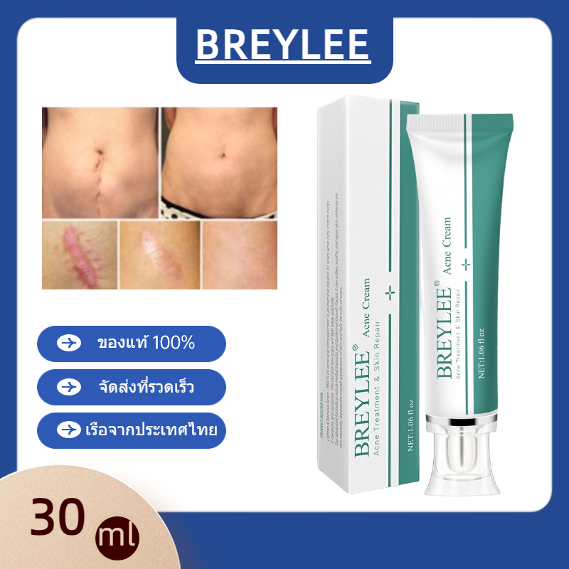 BREYLEE Ance Cream 30g ครีมลดรอยแผลเป็น ครีมลบรอยแผลเป็นจากสิว