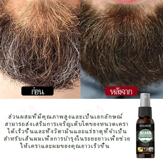 Eelhoe เซรั่มปลูกคิ้ว เซรั่มปลูกคิ้ว เซรั่มปลูกหนวด เซรั่มปลูกคิ้ว เซรั่มปลูกเครา น้ํายาปลูกผม น้ํายาปลูกหนวด