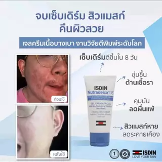 ISDIN Nutradeica® DS Facial Gel Cream เจลครีม ดูแลผิวเซ็บเดิร์มและสิวจากการ ใส่ mask ผิวชุ่มชื้น ปรับสมดุลผิว ลดอาการคัน