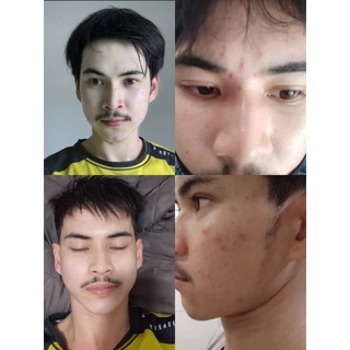 สบู่เอวาน่า สูตรกุหลาบน้ำผึ้ง ลดสิว หน้าขาวกระจ่างใส [AVANA IP BRIGHT ของแท้บริษัท]