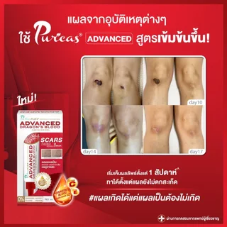 เซ็ตทดลอง จัดการทุกรอยแผล Puricas scar 3g.หรือ Intensive Dark Spot 3g. หรือ Advanced 3g.