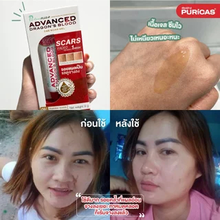 Puricas Plus Advanced Dragon's Blood C&E Scar Gel 3g. (ขนาดทดลอง) เจลลดรอยแผลเป็น