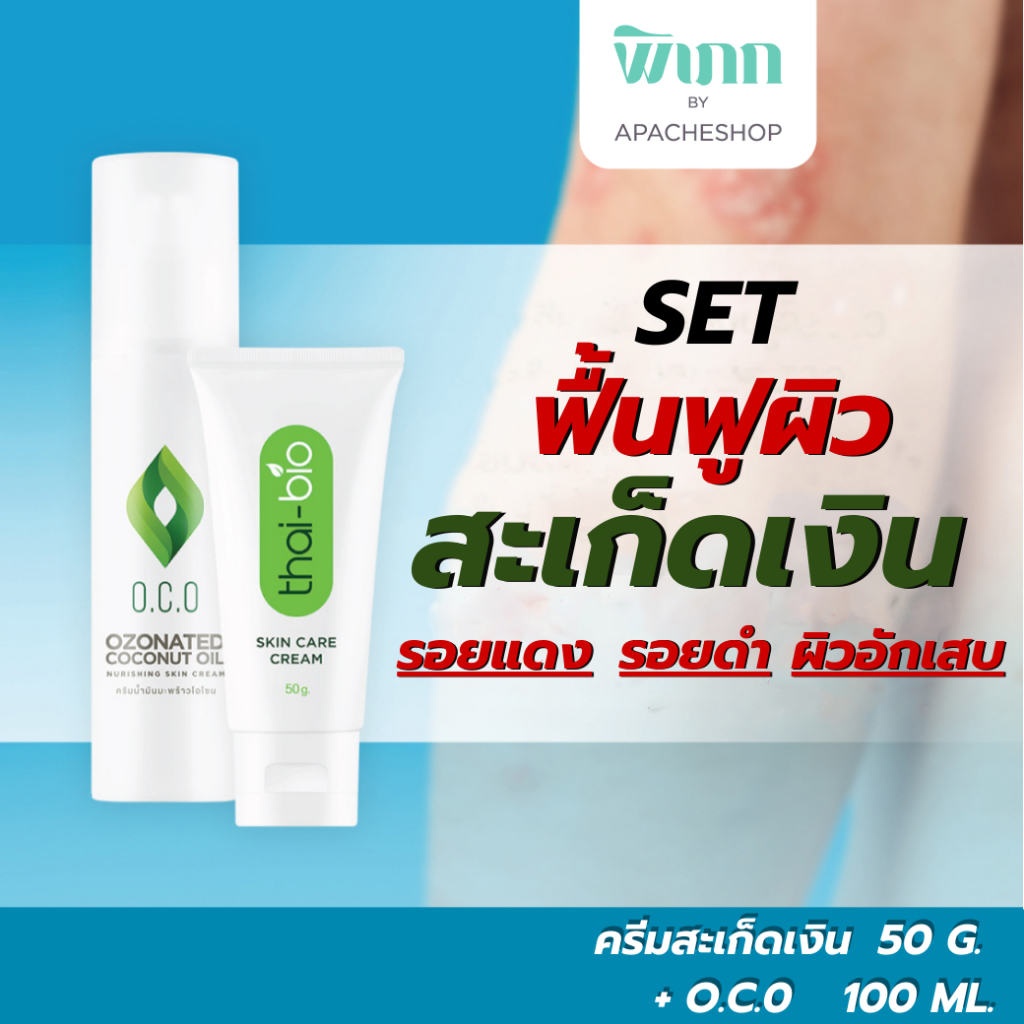 Thai-Bio ครีมสะเก็ดเงิน คู่ OCO อาการคัน การอักเสบ รอยแดง รอยดำ กลากเกลื้อน เชื้อรา โรคผิวหนัง ครีมบำรุงผิว สะเก็ดเงิน