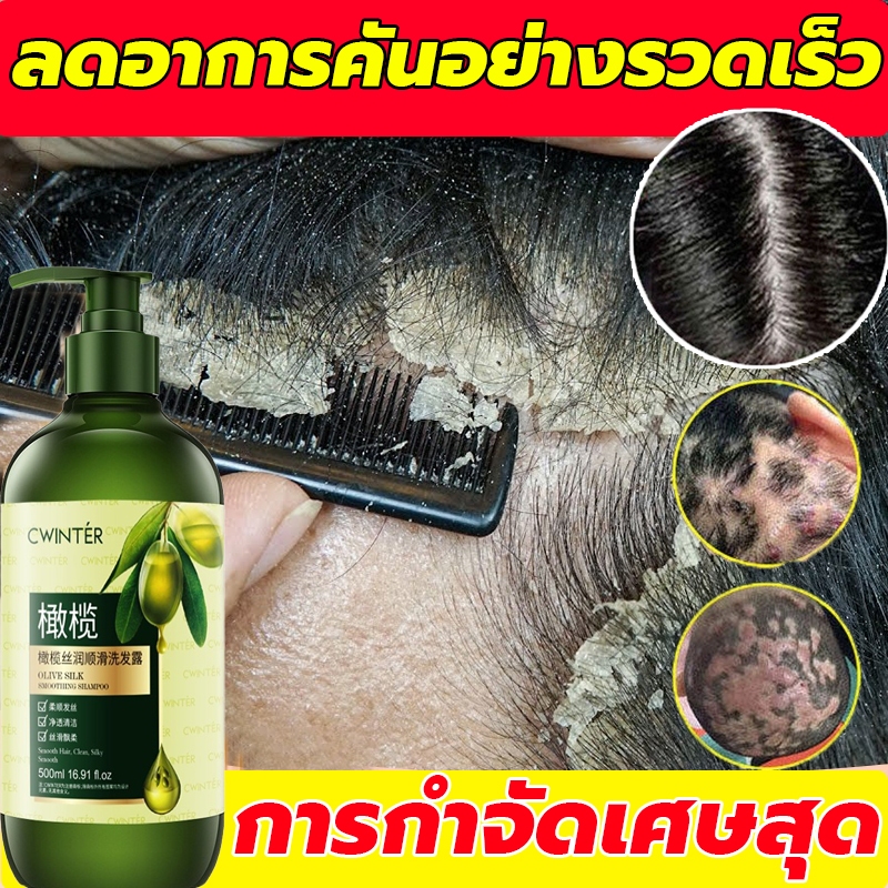แชมพูรังแค แชมพูแก้คัน แชมพูผมร่วง ขจัดรังแค ลดรังแค สารสกัดจากพืชมะกอก กลิ่นหอมยาวนาน สมุนไพร ลดความมันบนหนังศีรษะ