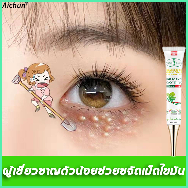 Aichun เม็ดไขมัน 30ml ลบคล้ำบวมใต้ตา กระชับรอยตีนกา ลดเม็ดไขมัน ฟื้นฟูผิวตา ครีมทารอบดวงตา เซรั่มทาถุงใต้ตา
