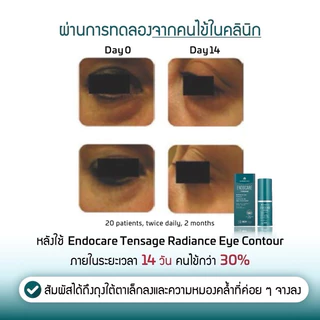 ส่งฟรี Endocare Serum Concentrate/Tensage/Ampoule/SCA 50% เซรั่มบำรุงผิว เมือกหอยทาก sca40 sca50