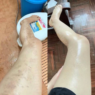3 Step Set ครบขั้นตอนการผลัดเซลล์ผิวและบำรุง สำหรับผู้ที่มีปัญหาผิวเยอะ