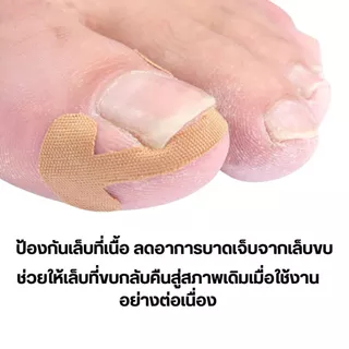 Happy Stepเทปพลาสเตอร์ติดกันเล็บขบ เล็บฝังลึกนิ้วเท้า เทปแปะกันเล็บขบเนื้อ ลดอาการบาดเจ็บ จากเล็บขบซ่อมเล็บ1แผ่นมี4ชื้น