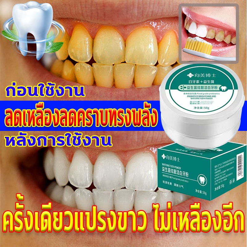 ลดฟันเหลือง ผงฟอกฟันขาว ลดกลิ่นปาก ป้องกันฟันผุ ผงฟอกสีฟัน แนะนำโดยทันตแพทย์ ผงฟอกฟันไวท์อัพ