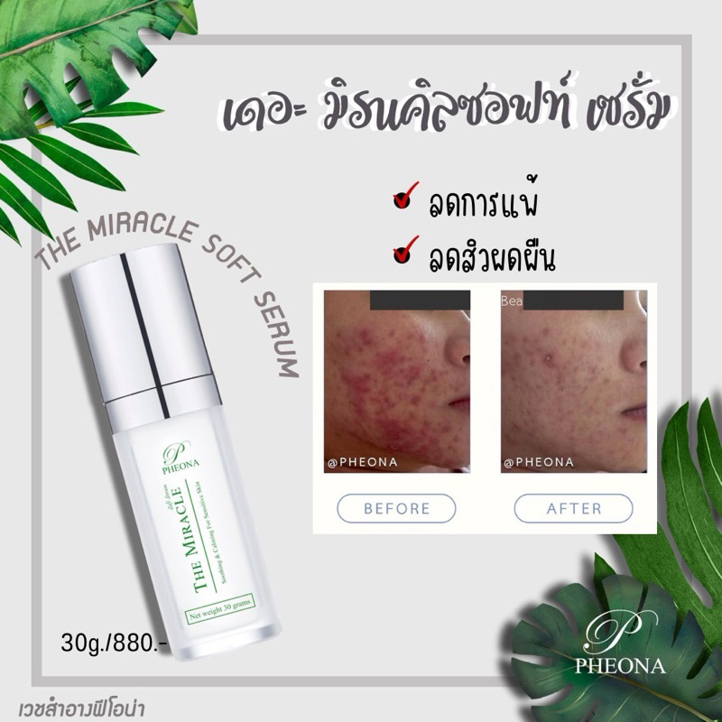 ฟีโอน่า เดอะ มิราเคิล ซอฟท์ เซรั่มพักผิว ฟื้นฟูผิว ของคนผิวแพ้ง่าย PHEONA THE MIRACLE SOFT SERUM ขนาด 30 g.