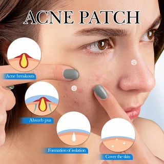 แผ่นสติกเกอร์แปะสิว แผ่นสิว สําหรับติดตกแต่งสิว แผ่นแปะดูดสิว แผ่นดูดสิว น่ารักแผ่นแปะสิว น่ารัก