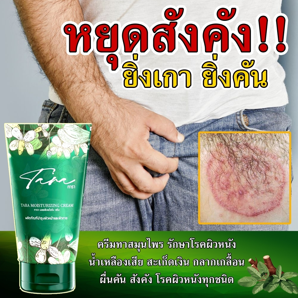 สมุนไพร ครีมทารา ทาสังคัง ทาผิวหนัง ปลอดภัย ผลิตจากธรรมชาติ ใช้ทาผิวหนังทุกชนิด