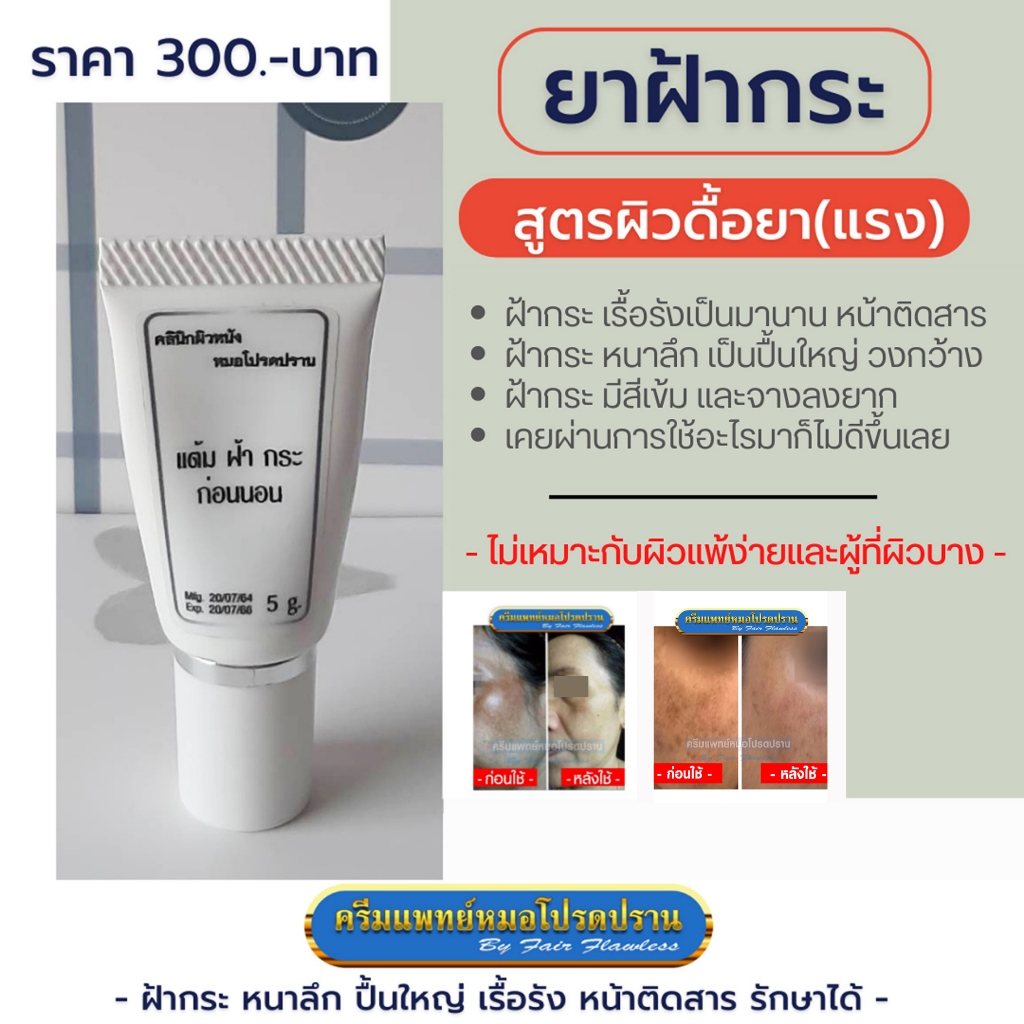 ครีมยาทาฝ้า กระ สูตรผิวดื้อยา มีของแถม(ครีมแพทย์หมอโปรดปราน)