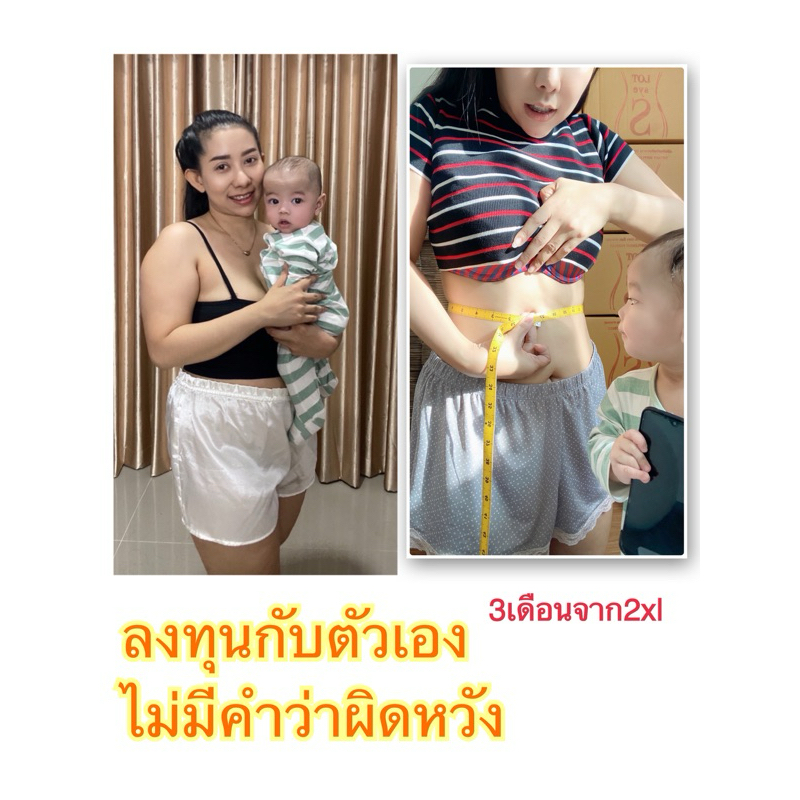 Set3กระปุกLOT Sye S เสริมอาหารชนิดแคปซูลลดบวมคุมหิว