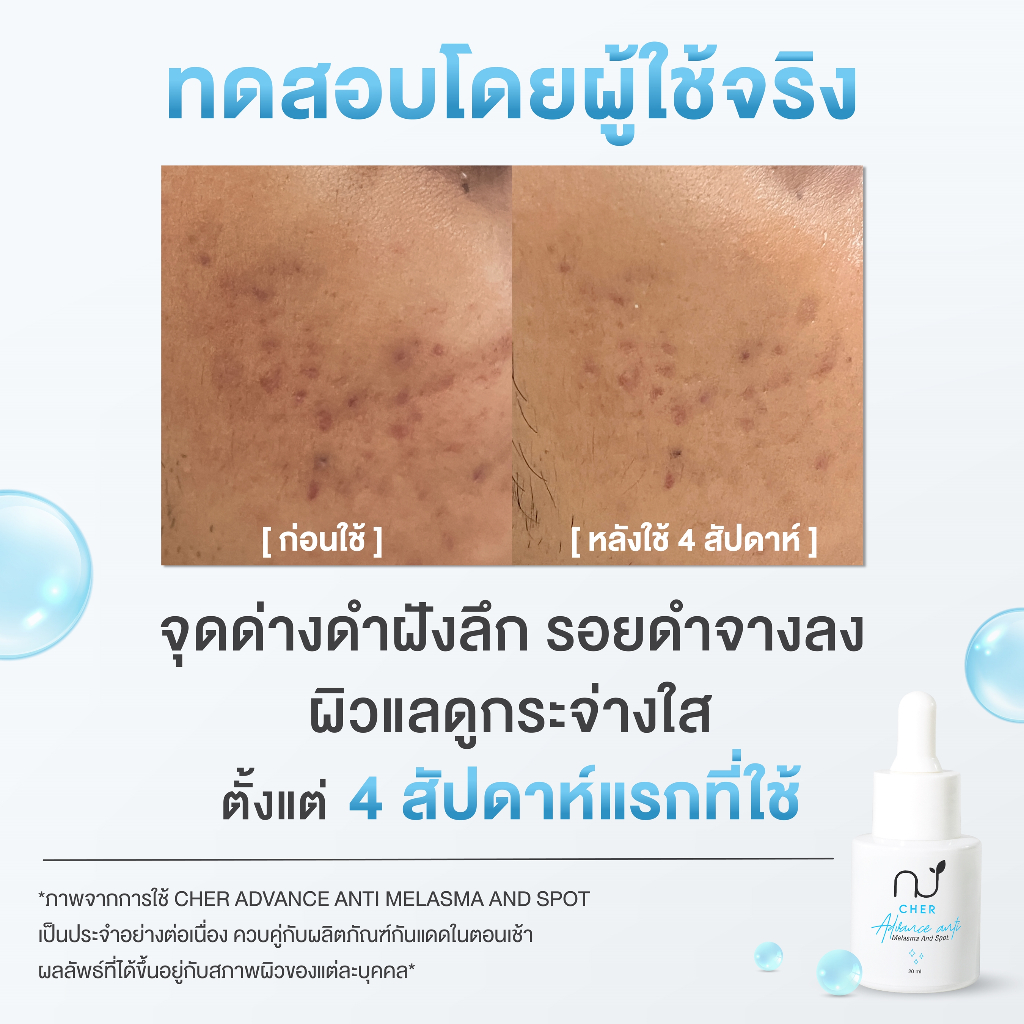 CHER Advance Anti Melasma And Spot เฌอ เซรั่มยับยั้ง 4 กลไก การเกิดฝ้า กระ จุดด่างดำ 20 mL - รูปที่ 3