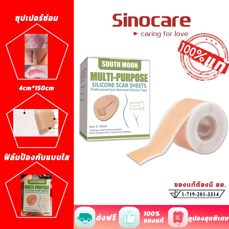 South Moon รักษารอยแผลเป็น แผ่นแปะแผลเป็น 4cm*150cm กําจัดรอยแผลเป็นจากแผลเป็น เผยผิวเนียนสวย