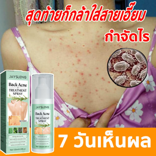 JAYSUING สเปรย์รักษาสิวที่หลัง สิวหน้าอก สิวใบหน้า สูตรแพทย์แผนไทย Acne Body Spray สเปรย์ฉีดสิวที่ผิวกาย 120มล