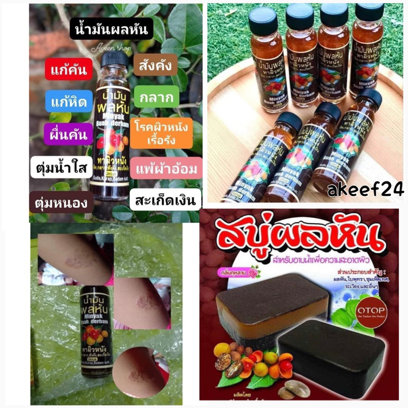 น้ำมันลูกหัน สบู่ลูกหัน หิด กลาก เกลื้อน สะเก็ดเงินหายเกลี้ยง