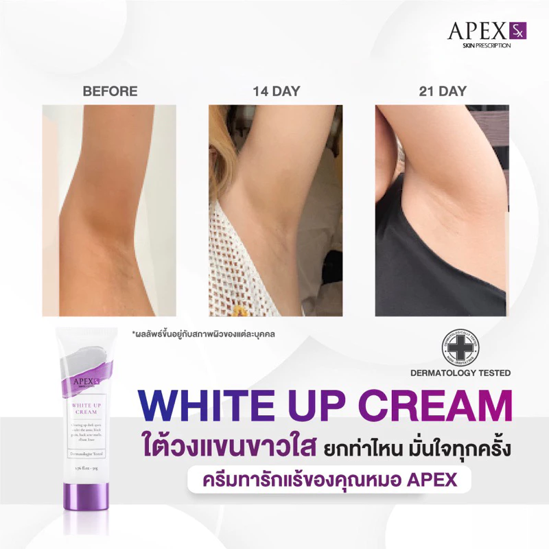 APEX-SX WHITE UP CREAM ครีมทารักแร้ขาว โดยแพทย์ผิวหนังเอเพ็กซ์ ทาขาหนีบดำ แก้มก้นดำ 50 ml. thumbnail 8