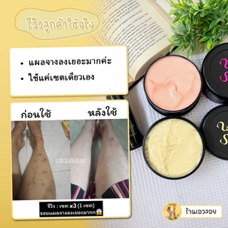 เซต x3 (Secret me) ⭐ ตะกร้าสำรอง ⭐ผิวขาวใส ลดรอยดำคล้ำ จุดด่างดำ รอยแตกลาย body lotion