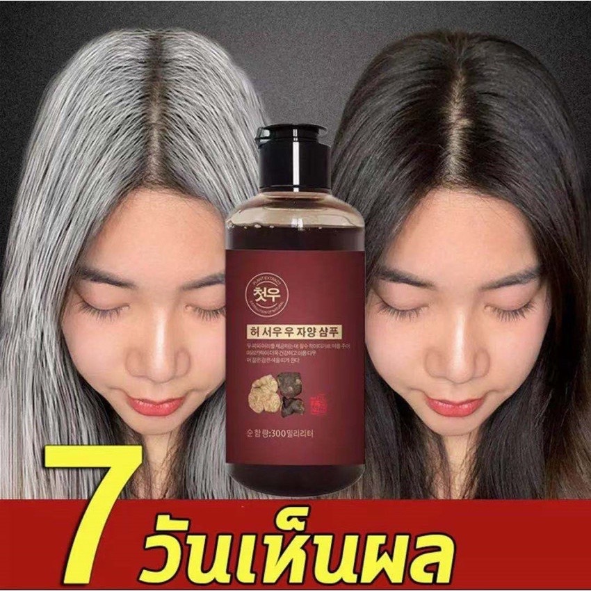 แชมพูปลูกผม ผมดกสารสกัดน้ำมันขิง เข้มข้น JOMTAM300ml ปลูกผมใน 28 วัน ป้องกันผมร่วง ปรับระดับสมดุลย์น้ำมันที่หนังศีรษะ