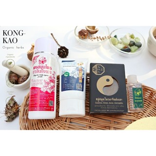 เซตรักษาครบสูตรเชื้อรา กลาก เกลื้อน สะเก็ดเงิน สังคัง หายขาด…