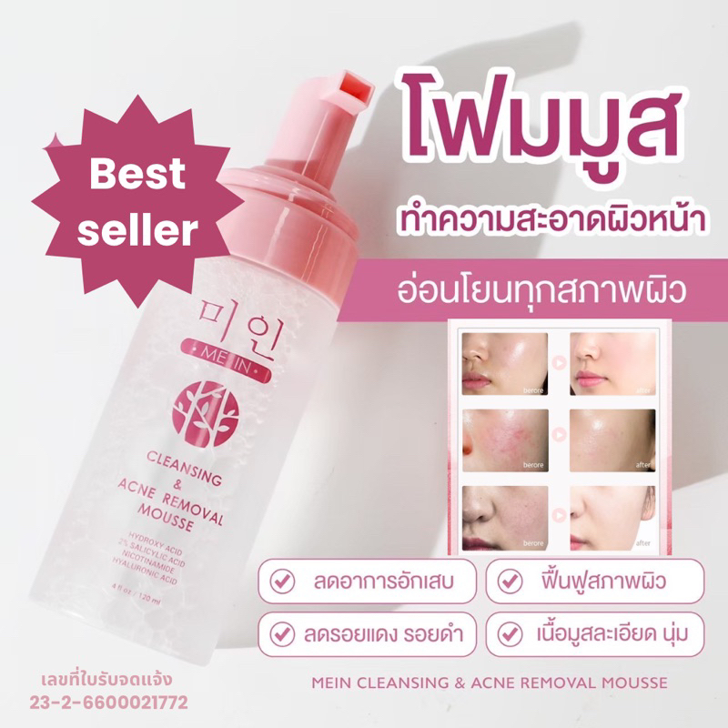 MEIN CLEANSING & ACNE REMOVAL MOUSSE คลีนซิ่ง โฟมมูส ทำความสะอาดล้ำลึก ลดสิว กระชับรูขุมขน
