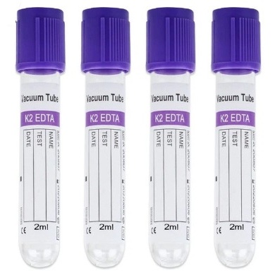 EDTA K2 Vacuum Blood Collection Tube/หลอดสูญญากาศ EDTA K2