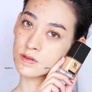✅ พร้อมส่ง ✅ รองพื้นปิดฝ้า Cherben ของแท้จากบริษัท