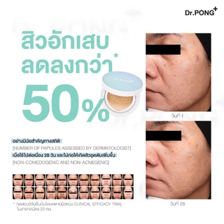 Dr.PONG ACNE ACE LONGWEAR CUSHION คุชชั่นลดสิว ยืนยันด้วยงานวิจัย ผิวไม่อุดตัน