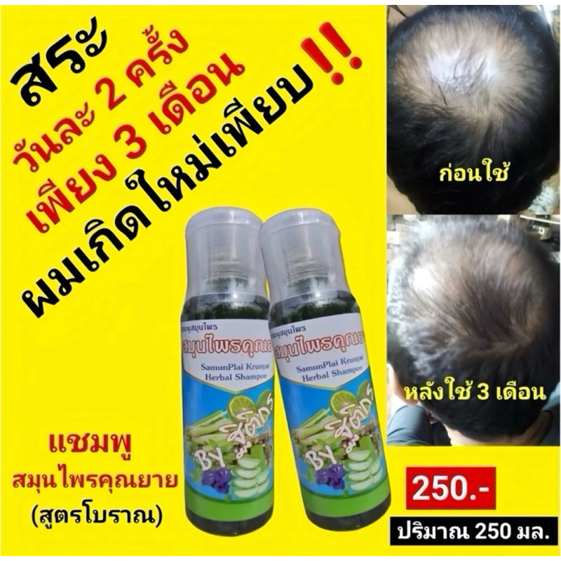 แชมพูแก้ผมบาง สูตรสมุนไพร 17 ชนิด ยาสระผมสมุนไพร แชมพูสมุนไพรคุณยาย สูตรคุณยาย