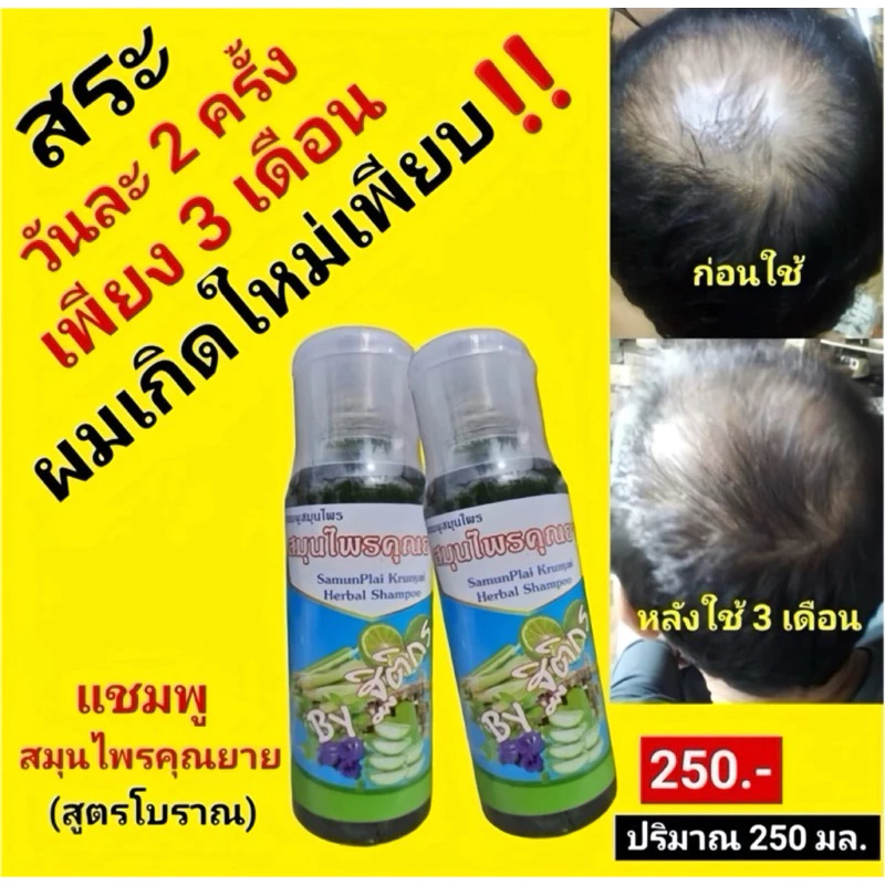 พร้อมส่ง🐧แชมพูแก้ผมบาง [มีของแถม] สูตรสมุนไพร 17 ชนิด ยาสระผมสมุนไพร แชมพูสมุนไพรคุณยาย สูตรคุณยาย