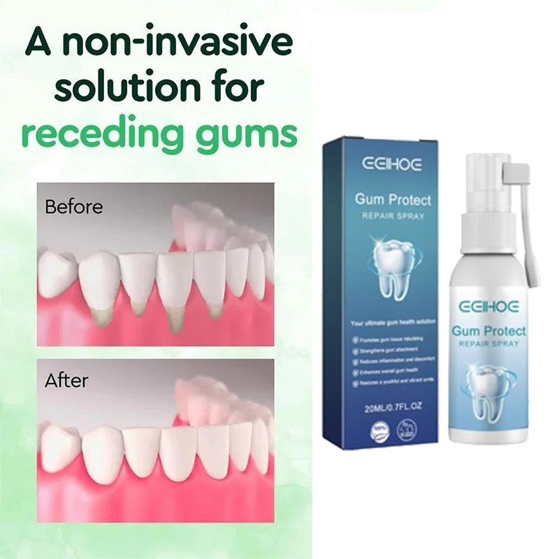Gum Protect Repair Mouth Spray ดูแลช่องปาก รักษาเหงือก ลดเสียวฟัน ซ่อมแซมช่องปาก บรรเทาอาการหมากฝรั่ง เหงือกร่น