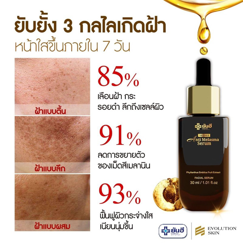 ในไลฟ์ลด 50%   YANHEE ANTI MELASMA SERUM ยันฮี แอนตี้ เมลาสม่า ซีรั่ม ลดฝ้า กระ จุดด่างดำผิวหมองคล้ำ ราคา ถูกที่สุด ดีลบีเคเค แกลเลอรีภาพที่ 5