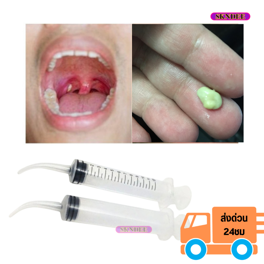 ไซริ้งค์ปลายโค้ง อุปกรณ์กำจัดนิ่วทอนซิล ไซริ้งฉีดฟันคุด ปลายงอ12 ml นิ่วทอมซินสาเหตุกลิ่นปาก tonsil remover 1ชิ้น