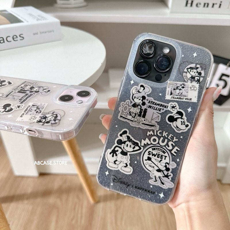 ( มีi15 ) เคส Gliter เม้า (ขอบนิ่ม)