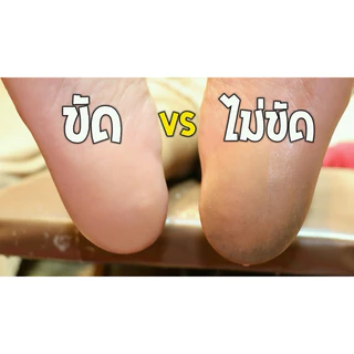 พร้อมส่ง📮สปาส้นเท้าแตก พร้อมอุปกรณ์ (โฟมขัด+ถุงมือ+สำลี) เห็นผลตั้งแต่ครั้งแรก
