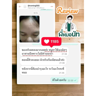 E02 ครีมทารักษาสิวผด สิวยีสต์ สิวผดร้อน ผิวติดสาร สูตรคลินิก สูตรพี่หมอนัท ป้องกันสิวผด รักษาสิวยีส คนเป็นสิว ผิวแพ้ง่าย