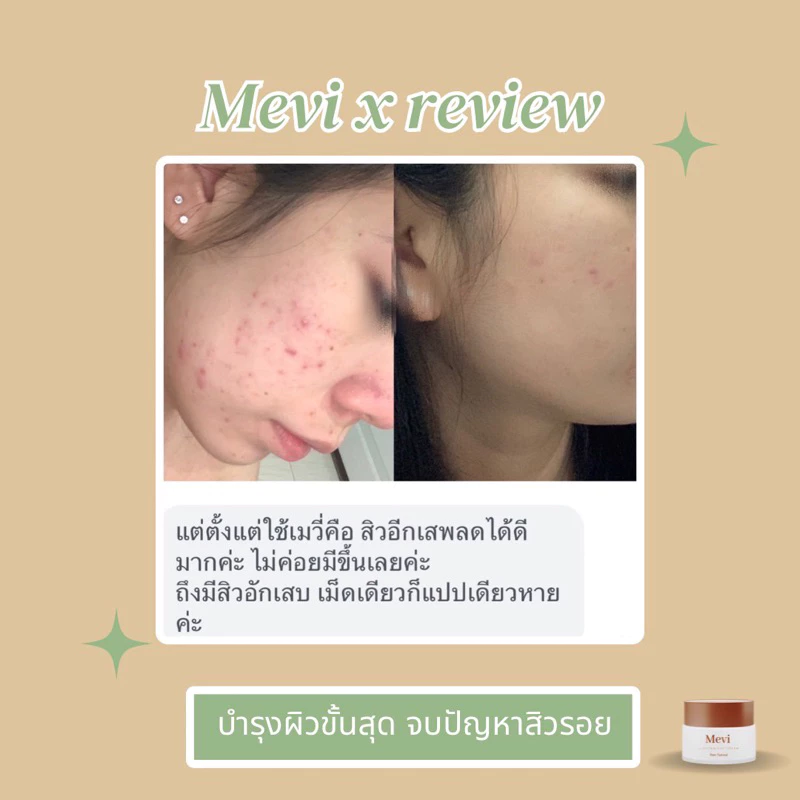 Mevi Moisturizer เมวี่มอยซ์เจอร์ไรเซอร์ 30g thumbnail 4