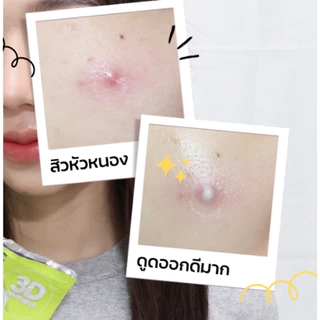 Jabs 3D Invisible Acne Patch แจ๊บส์ แผ่นแปะสิว 3D อินวิซิเบิล แอคเน่แพ็ทซ์ 1 ซอง 22 ชิ้น
