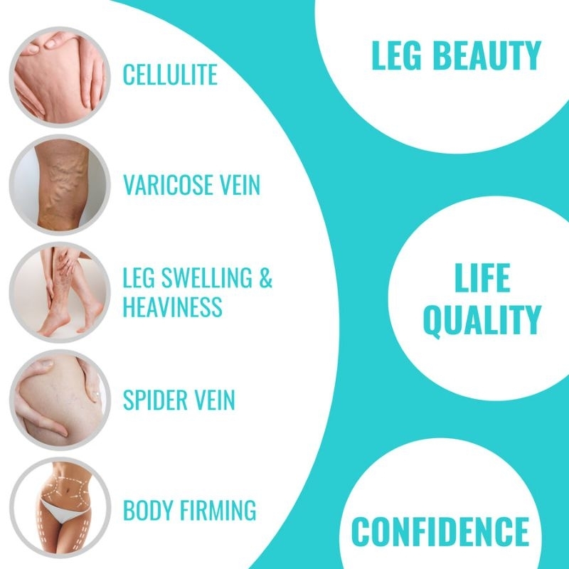 ✨️พร้อมส่ง✨️UpNourish Flawless Leg Anti Cellulite Supplements, 90 Capsules - รูปที่ 3