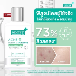 [ใหม่] Smooth E Acne-5 DETOX & MOISTURE LIQUID CLEANSER 50 / 100 ml. เจลล้างหน้าเนื้อโลชั่น สำหรับช่วงเป็นสิวหนัก คุมมัน