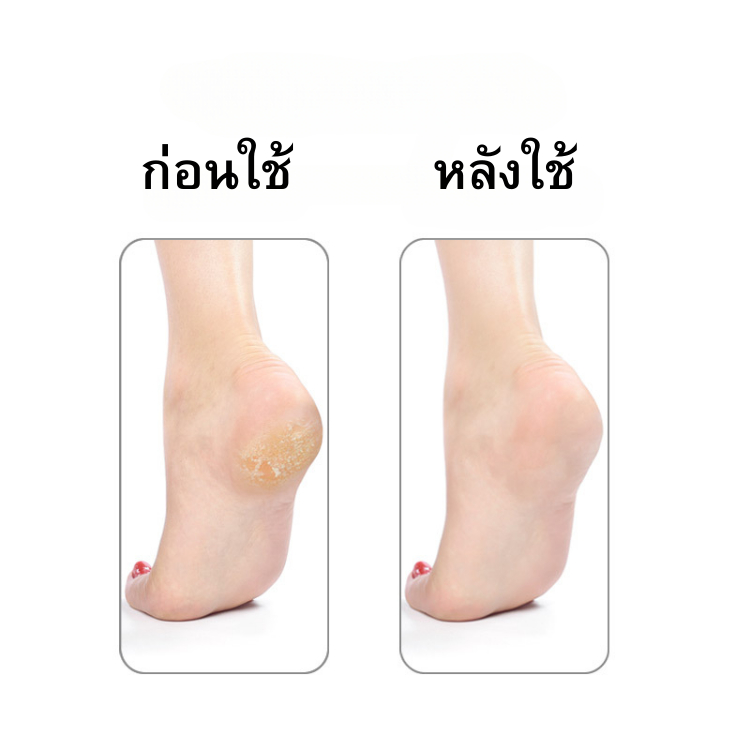 โฟมขัดส้นเท้า ฟองน้ำ PU ขัดส้นเท้าแตก ลดรอยแตก แห้งหยาบกร้าน - รูปที่ 3