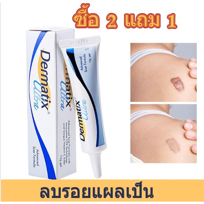 【ซื้อ 2 แถม 1】การจัดส่งภายในระบบ Dermatix Ultra Gelซ่อมแซมครีม ครีมลดรอยแผลเป็น มอยเจอร์ไรเซอร์ ใช้ได้ทั้งร่างกาย