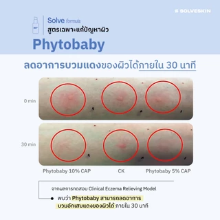 SOLVESKIN Calming & Strengthening Serum เซรั่มผิวแข็งแรง ชุ่มชื้น ลดผื่นแพ้ 35 ml.