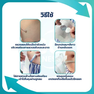 [360wellness อุปกรณ์เพื่อผู้สูงอายุ] (พร้อมส่ง) ถุงอาบน้ำผู้ป่วยไต กันน้ำได้ 100% สำหรับผู้ป่วยล้างไต ใช้แล้วทิ้ง