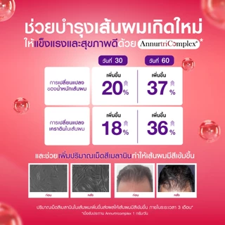 [เซตเห็นผล 4 กล่อง] Bomi Appotin Hare Gro (14x2g) บำรุงเส้นผม เสริมสร้างความแข็งแรงให้กับเส้นผม ลดการหลุดร่วง