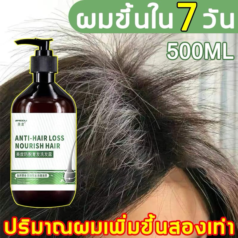 แชมพูแก้ผมร่วง 500ml เร่งการเจริญเติบโตของเส้นผมและป้องกันผมร่วง ยาสระผมขิง แชพูแก้ผมร่วงhair growth shampoo ของแท้100%