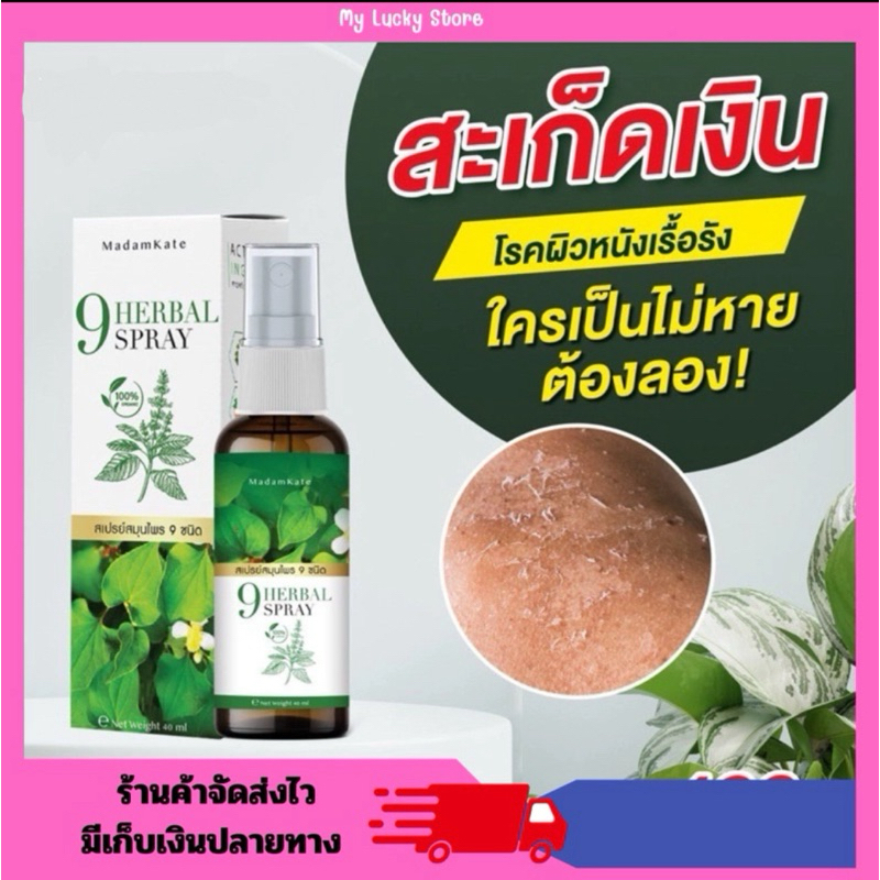 สเปรย์สมุนไพร กลากเกลื้อน เชื้อราผิวหนัง ผื่น ทาเชื้อรา สเก็ดเงิน สเก็ดทอง